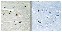 CSN1 Polyclonal Antibody