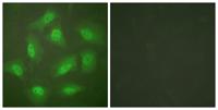 CSN3 Polyclonal Antibody