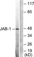 CSN3 Polyclonal Antibody