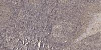 CSN3 Polyclonal Antibody