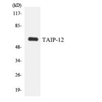 CSRNP2 Polyclonal Antibody