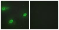 CstF-64 Polyclonal Antibody