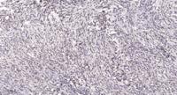 CstF-64 Polyclonal Antibody