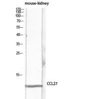 CTACK Polyclonal Antibody