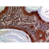 CTACK Polyclonal Antibody