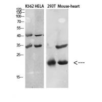 CTACK Polyclonal Antibody