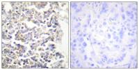 C-TAK1 Polyclonal Antibody