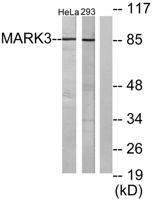 C-TAK1 Polyclonal Antibody