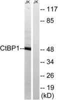 CtBP1 Polyclonal Antibody