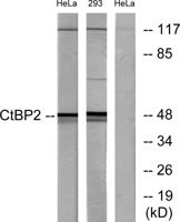 CtBP2 Polyclonal Antibody