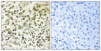 CTDSP1 Polyclonal Antibody