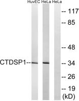 CTDSP1 Polyclonal Antibody