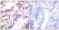 CtIP Polyclonal Antibody