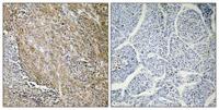 CTPS Polyclonal Antibody