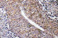 CTPS Polyclonal Antibody