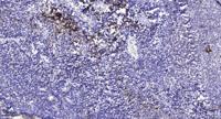 Cubilin Polyclonal Antibody