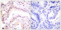 CUL-2 Polyclonal Antibody