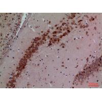 CUL-4B Polyclonal Antibody