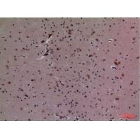 CUL-4B Polyclonal Antibody