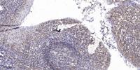 CUX1 Polyclonal Antibody