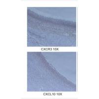 CXCR-3 Polyclonal Antibody