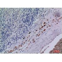 CXCR-3 Polyclonal Antibody