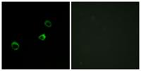 CYB561D1 Polyclonal Antibody