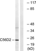 CYB561D2 Polyclonal Antibody