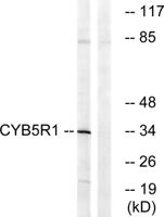CYB5R1 Polyclonal Antibody