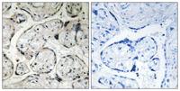 CYB5R3 Polyclonal Antibody