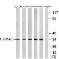 CYB5R3 Polyclonal Antibody