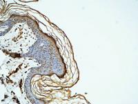 Cyclin D1 Polyclonal Antibody