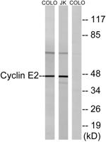 Cyclin E2 Polyclonal Antibody