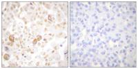 Cyclin F Polyclonal Antibody