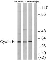 Cyclin H Polyclonal Antibody