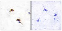 Cyclophilin F Polyclonal Antibody