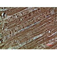 CYCS Polyclonal Antibody