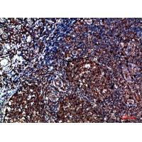 CYFIP2 Polyclonal Antibody
