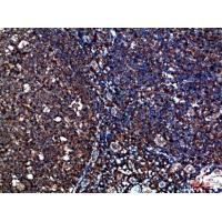 CYFIP2 Polyclonal Antibody