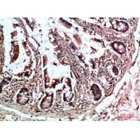 CYFIP2 Polyclonal Antibody