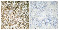 GATA-5 Polyclonal Antibody