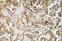 GATA-5 Polyclonal Antibody