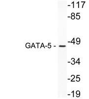 GATA-5 Polyclonal Antibody