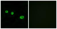 GBP1 Polyclonal Antibody