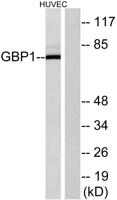 GBP1 Polyclonal Antibody