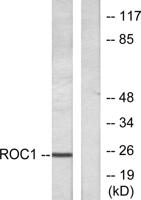 Rit1 Polyclonal Antibody