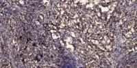 Rit1 Polyclonal Antibody