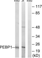 RKIP Polyclonal Antibody