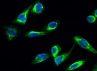 CYP17A1 Polyclonal Antibody