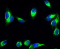 CYP19A1 Polyclonal Antibody